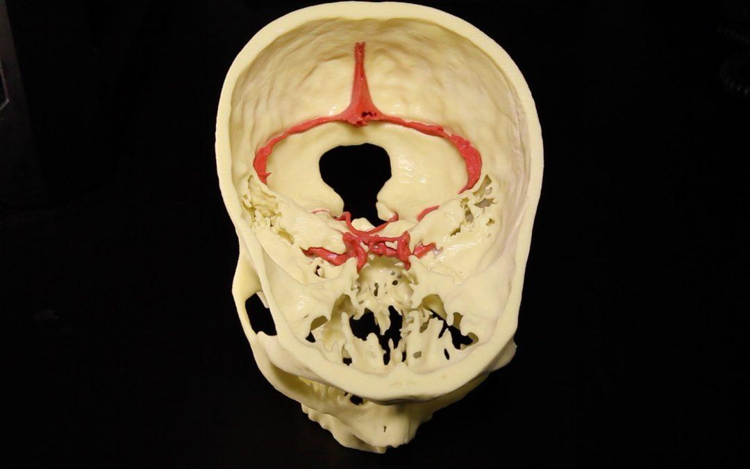 Mount Sinai Unveils Medical Modeling Core: Will Provide Virtual Reality, Simulation, and 3D Printing Services