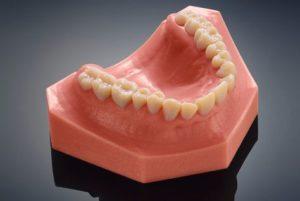 3d-printed-teeth-stratasys