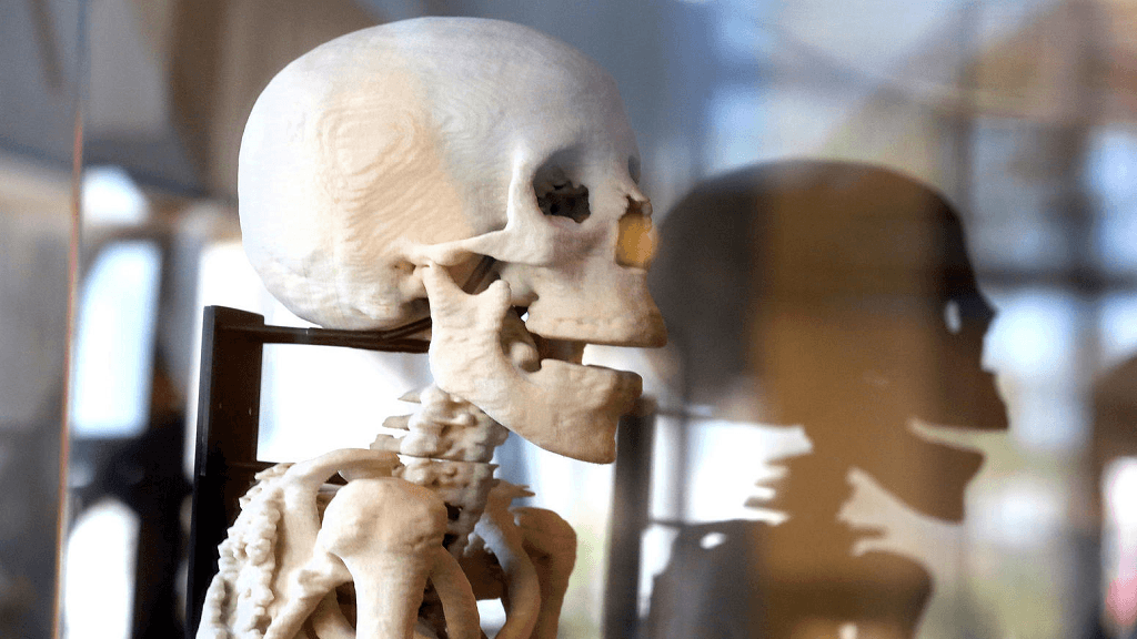 annie-skeleton