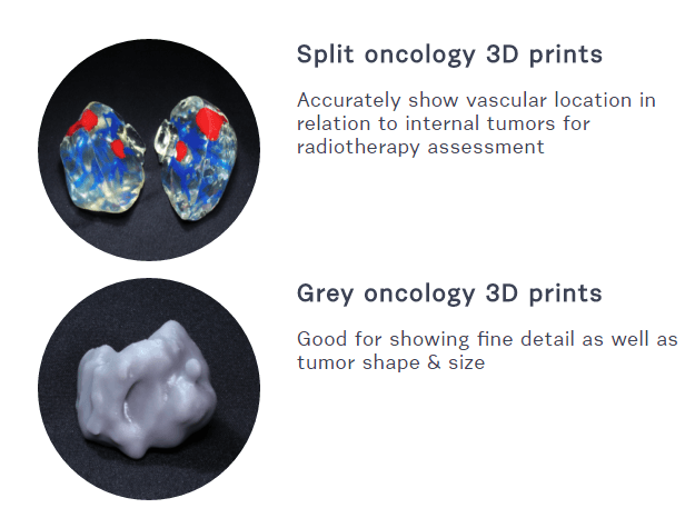 axial3d-oncology-3d-prints
