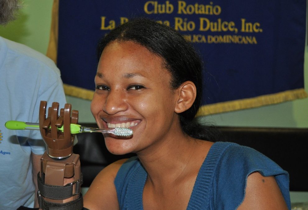Portland Rotary Club Works with e-NABLE to Deliver 3D Printed Prosthetic Limbs to Amputees in the Dominican Republic