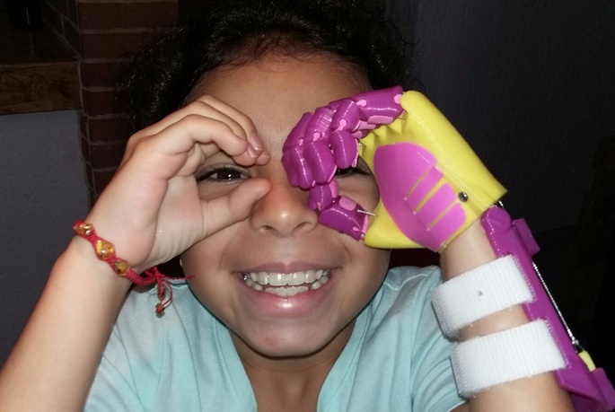 Re:Purpose for Good Pursues Several Good Causes at Once with 3D Printed Prosthetics Made from Recycled Plastic