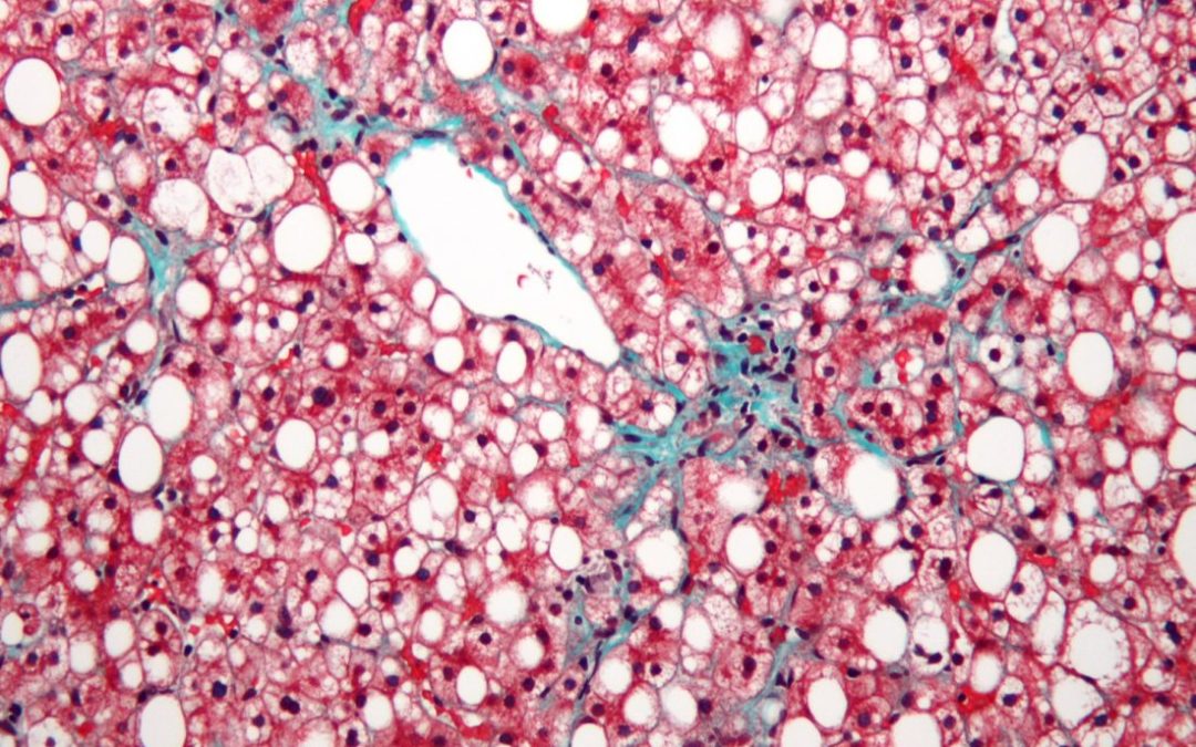 Organovo & Viscient Biosciences Collaborate for 3D Bioprinting in Liver Disease Research