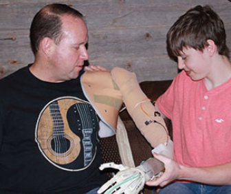 Son Creates 3D Printed Prosthetic Arm For Father With Help From DSM ...