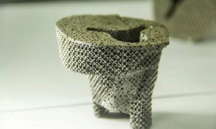 Chinese Hospital Uses 3D Printed Tantalum Implant in Successful Knee Replacement Surgery
