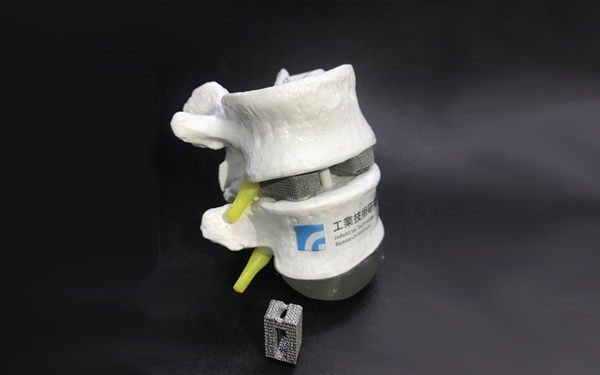 ITRI Researchers Develop 3D Printed Bone Specifically for Ethnically Chinese People