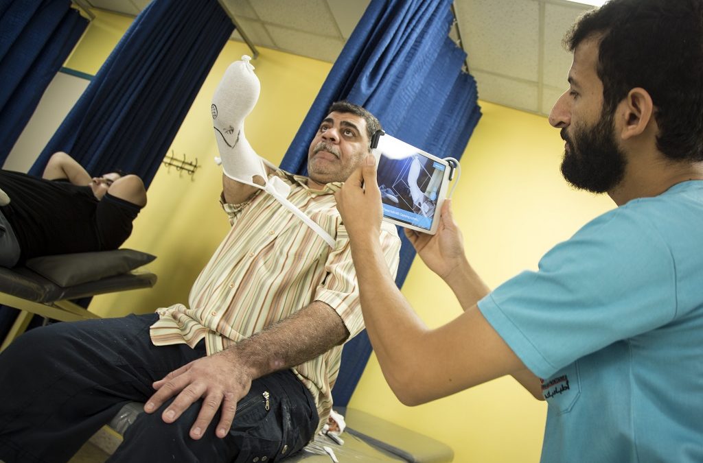 3D Printed Prosthetics Help Patients Heal in MSF Amman Reconstructive Surgery Hospital