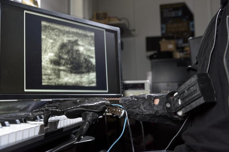 3D Technology Provides Musician with Skywalker Hand