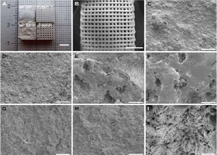 Making Better 3D Printed Bone Scaffolds at Low Temperatures with Robocasting Technique