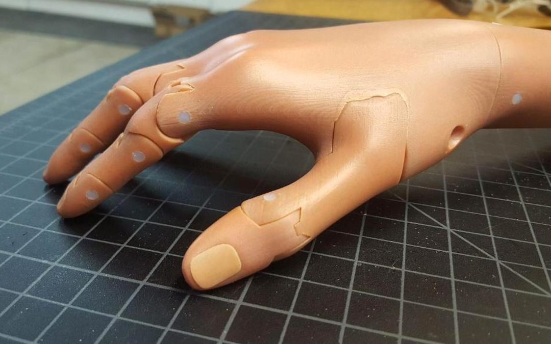 Tenacity and Empathy: Unlimited Tomorrow and Stratasys Discuss 3D Printing, Prosthetics, Partnership