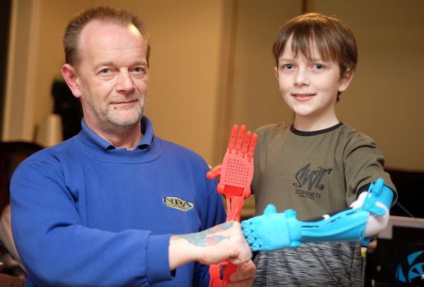 Dad designs and 3D prints a prosthetic arm for his son