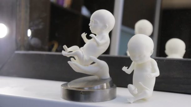 Embryo 3D: Expectant Parents in Russia Hold 3D Printed Likenesses of ...
