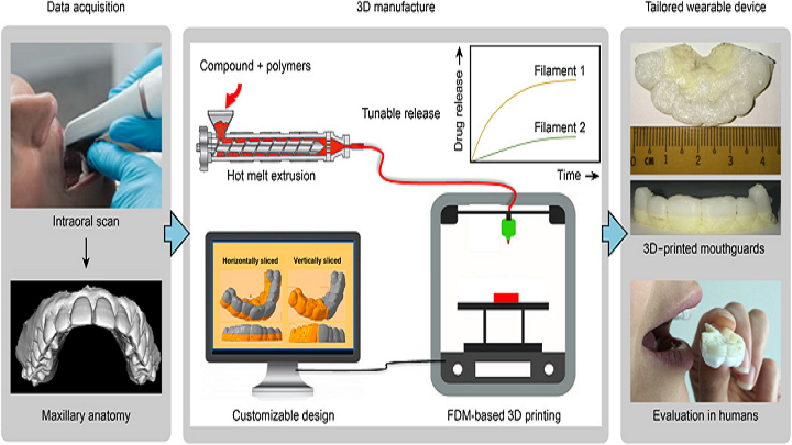 3D Printed Mouthguards Designed for Use as Customized Drug Delivery Devices