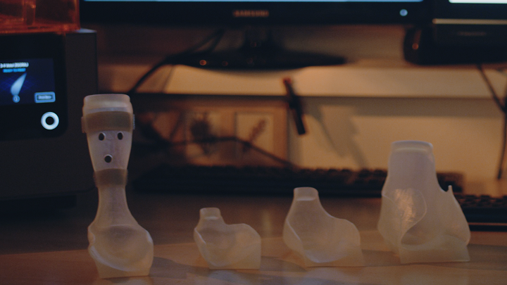 Father Takes Up 3D Printing, and Founds New Company, to Create Son’s Custom Orthosis