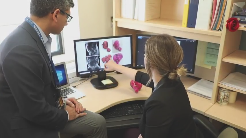 Historic Surgery Uses 3D Printing to Remove Nearly 50 Tumors from Woman’s Uterus