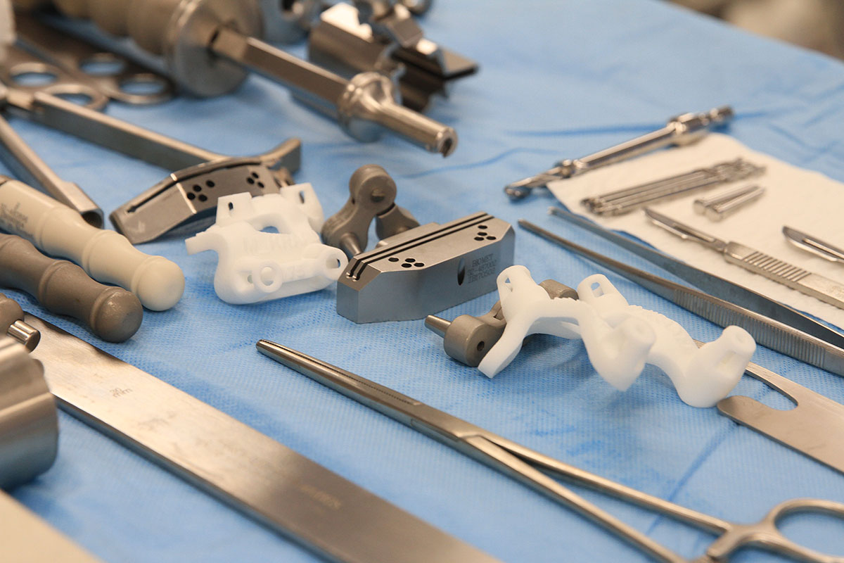Using PatientSpecific 3D Printed Surgical Guides for Total Knee