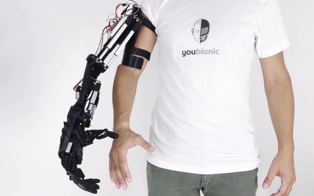 New and Improved Youbionic Arm Released