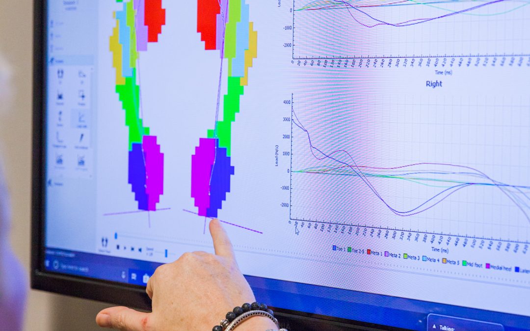 HP Has a One Sized Fits All 3D Printing Solution For Orthotics With Flowbuilt, Materialise and Go 4-D