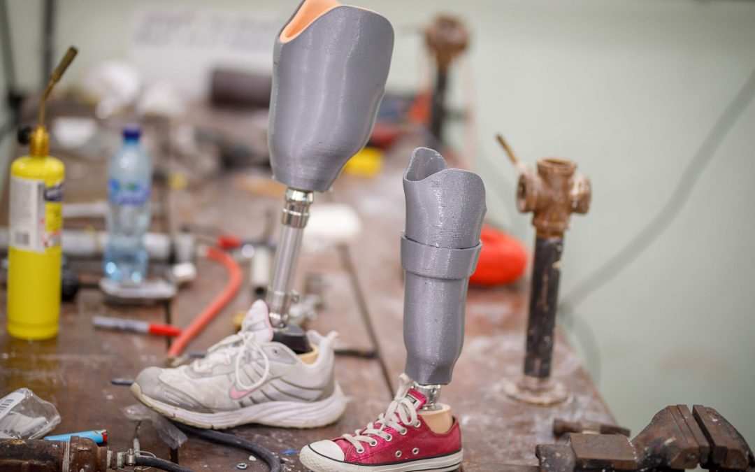 Interview with Prosthetist and Orthotist Brent Wright of LifeEnabled on 3D Printing Prosthetics