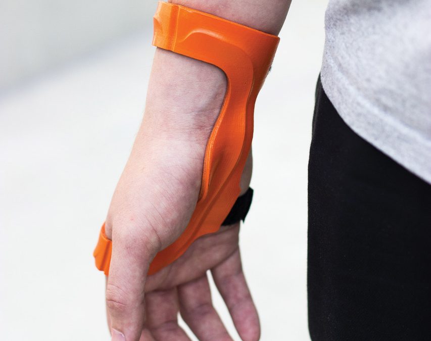 Twikit’s Twikbot Brings Mass Customization Using 3D Printing To Prosthetics and Orthotics