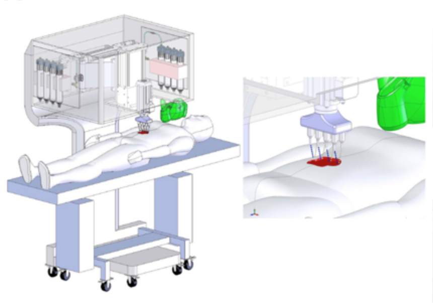 Illustration of functioning of bioprinting machine
