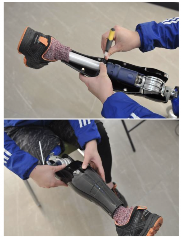 Customized Prosthetics Shell By 3d Scanning And Printing The Voice Of 3d