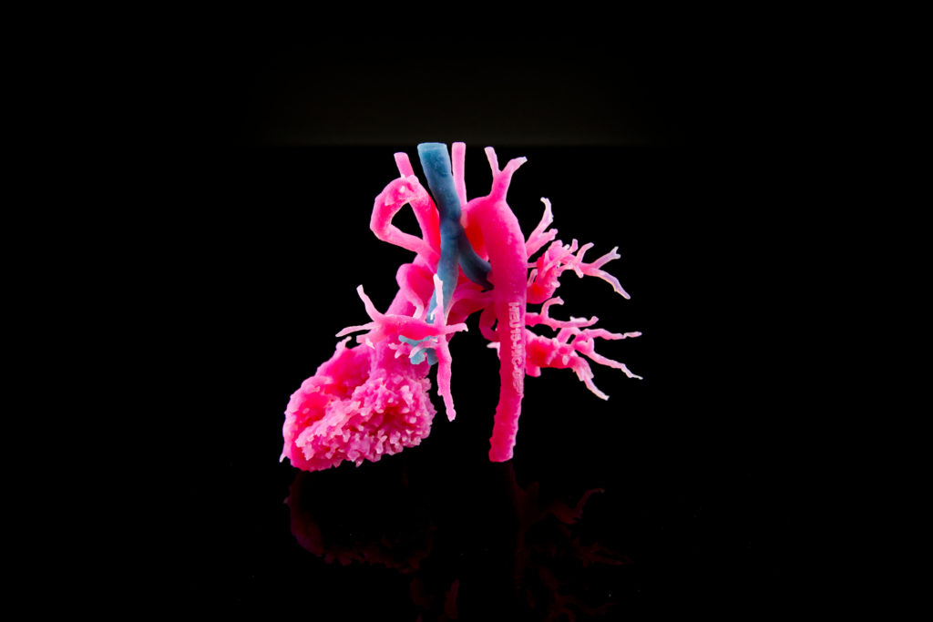 3D Printing Brings Confidence, Efficiency to Surgical Planning and Modeling