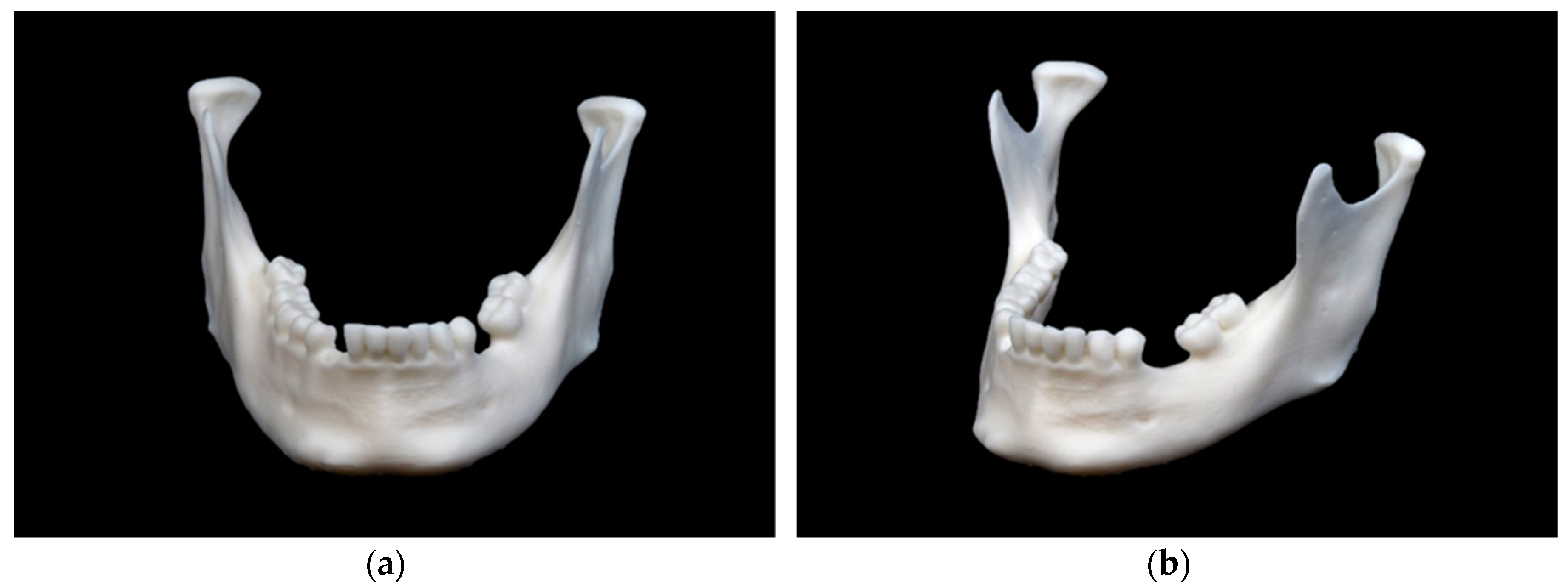 mandibula stl file 3D Models to Print - yeggi