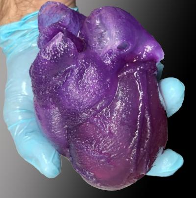 Full-sized FRESH 3D bioprinted heart model.