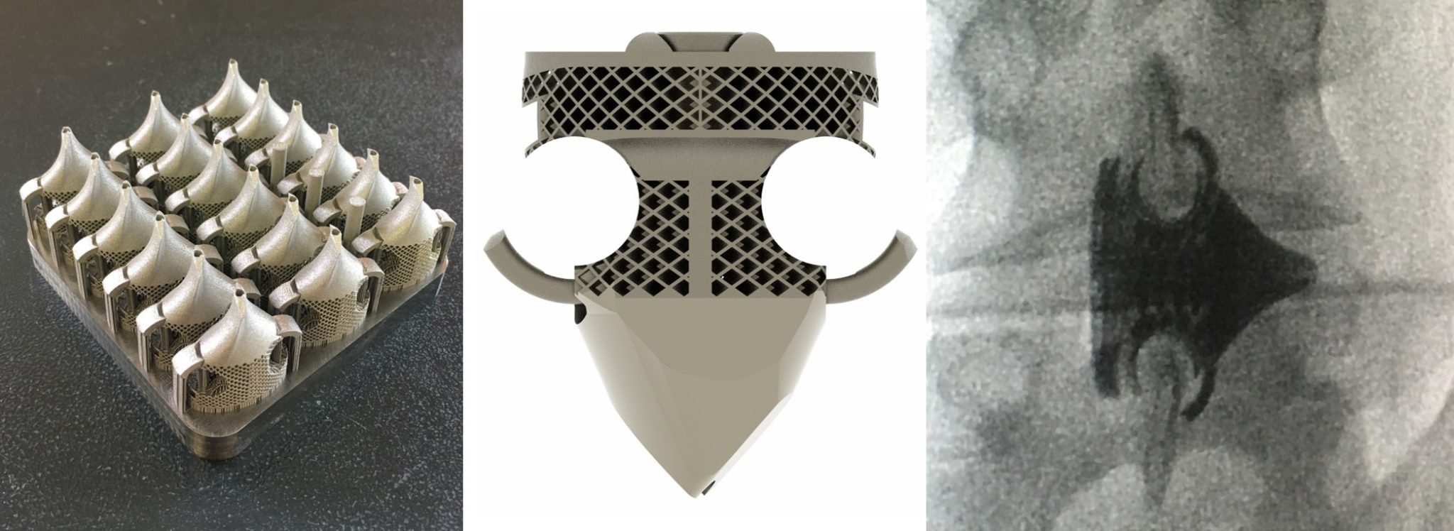 Picture Idea: Tsunami Medical Expands Ge Additive Metal 3D Printing Fleet For