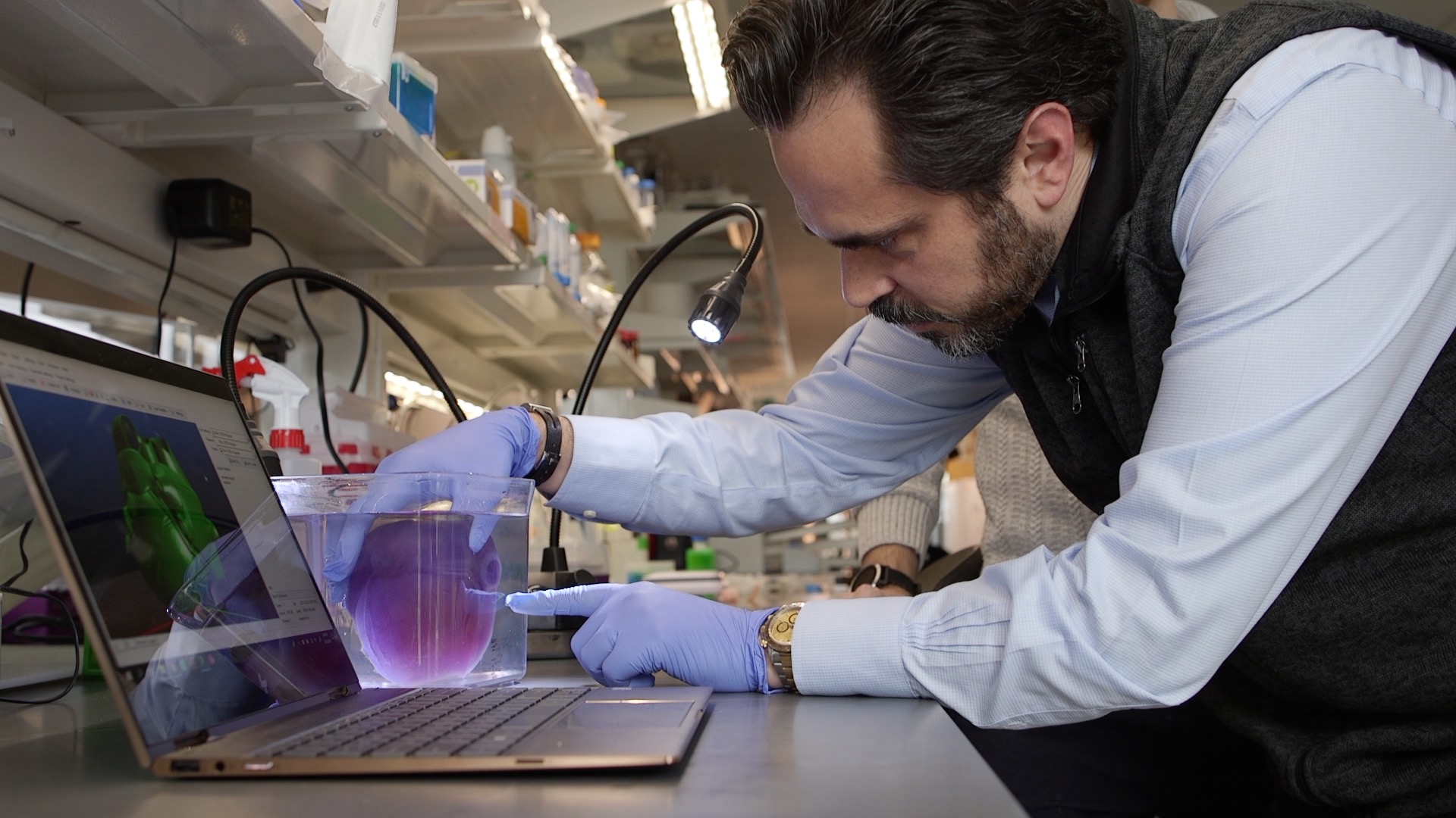 Looking towards a FRESH future in 3D bioprinting - 3DPrint.com ...