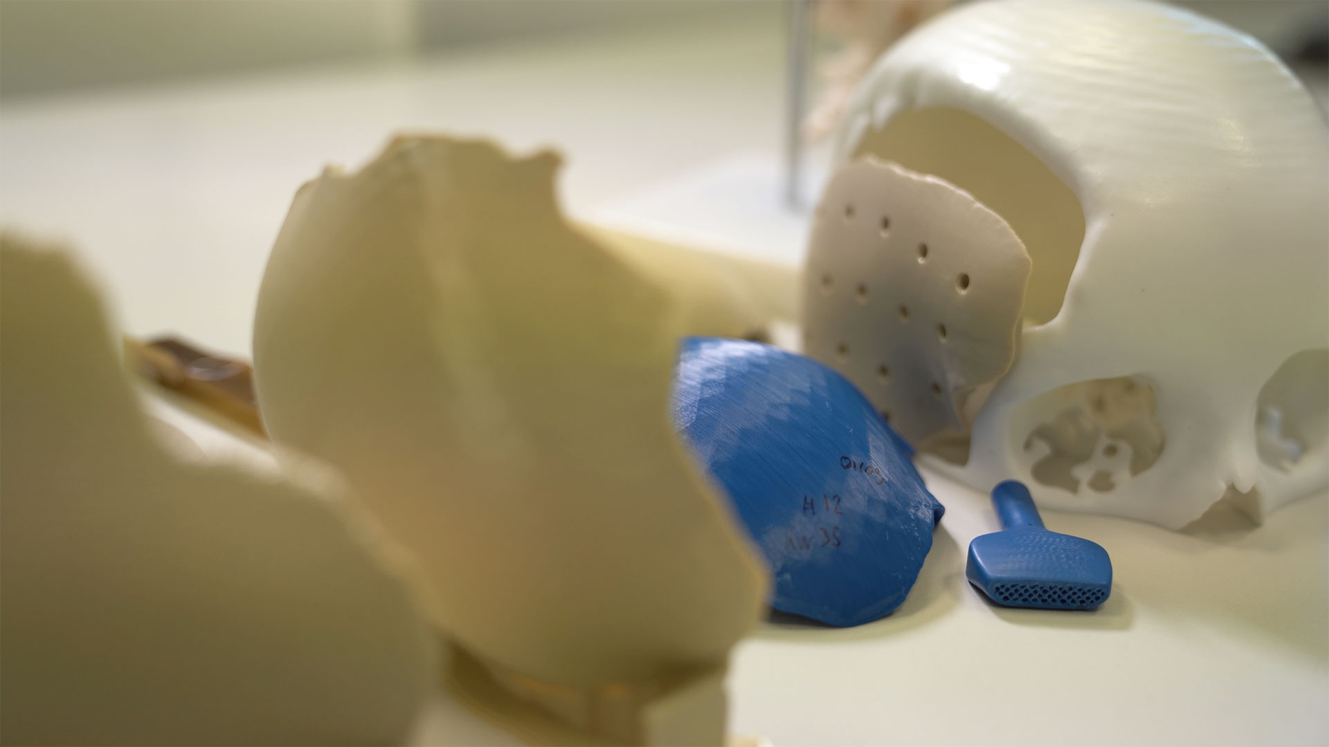 Kumovis 3D printing solutions leverage a variety of polymers and medical applications ranging from cranioplasty to spinal fusion surgery. 