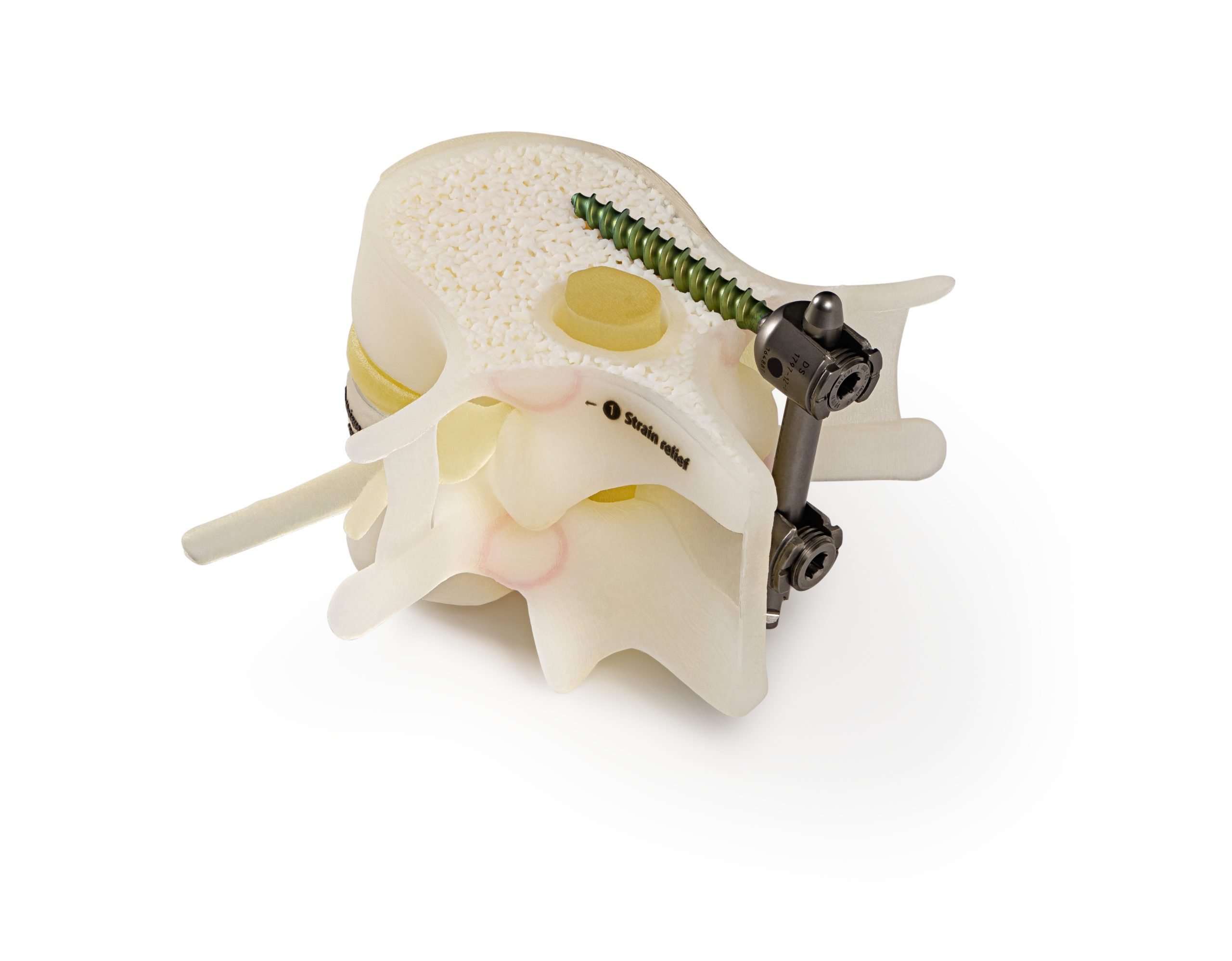 Spinal pedicel screw insertion 3D printed with Stratasys J750 Digital.