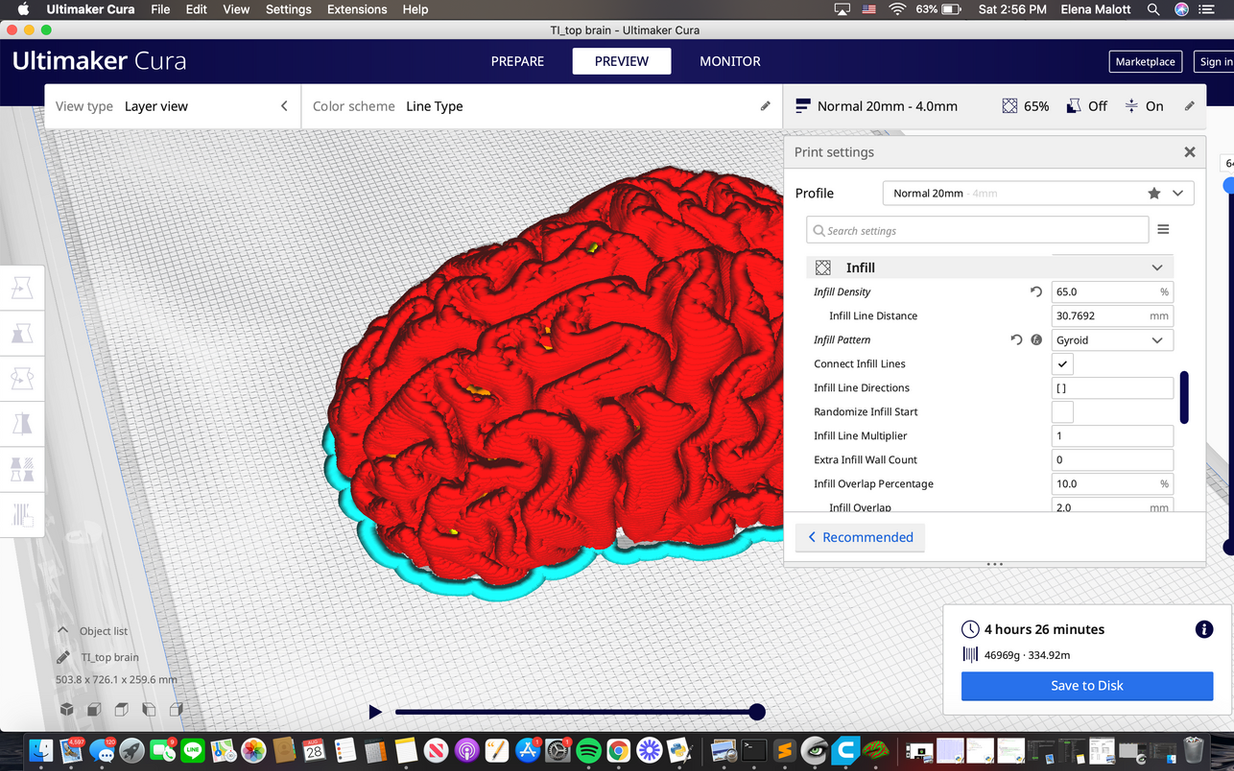 Elena Malott used 3D slicing software Ultimaker Cura to create a 3D model of the brain. 