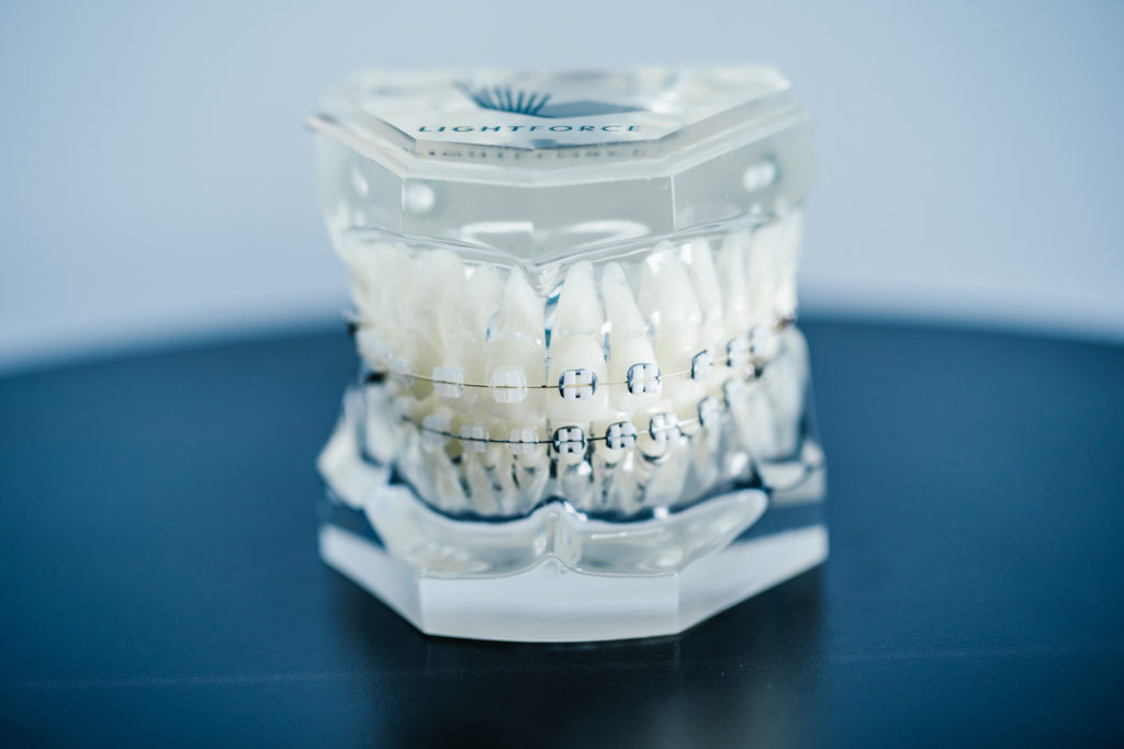 LightForce Orthodontics' new translucent braces