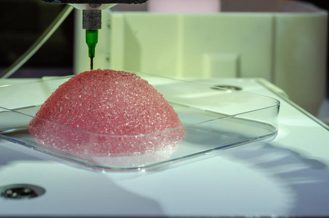 3D Printed Breast Reconstruction to Get .8M Increase – 3DPrint.com