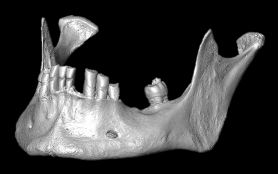 A digital reconstruction of a micro-XCT scan of a mandible