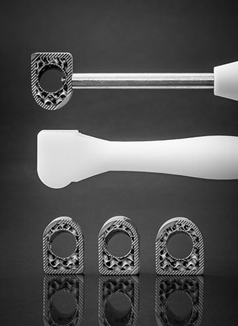 3D printed subtalar wedge system