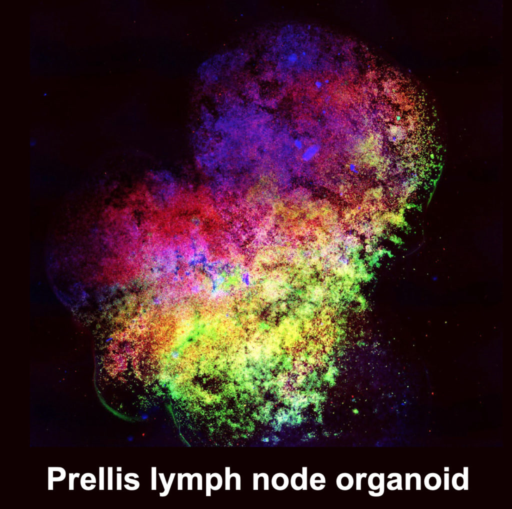 Microscopy image of a Lymph Node Organoid (LNO), used to recapture human immune responses in vitro.